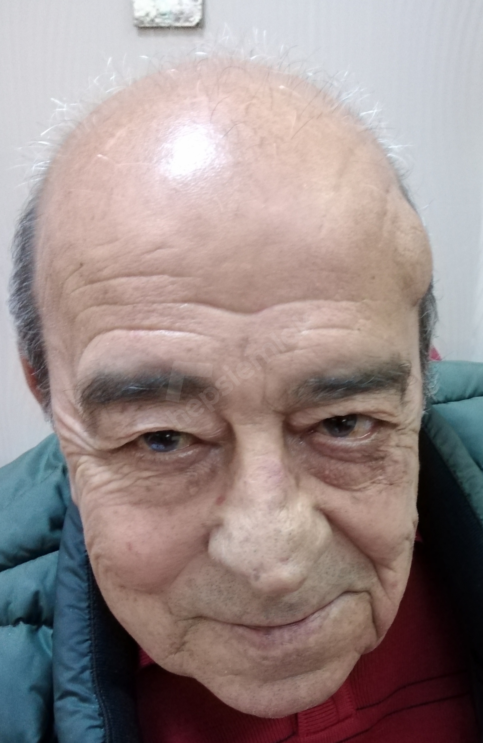 İLKER KARABEY